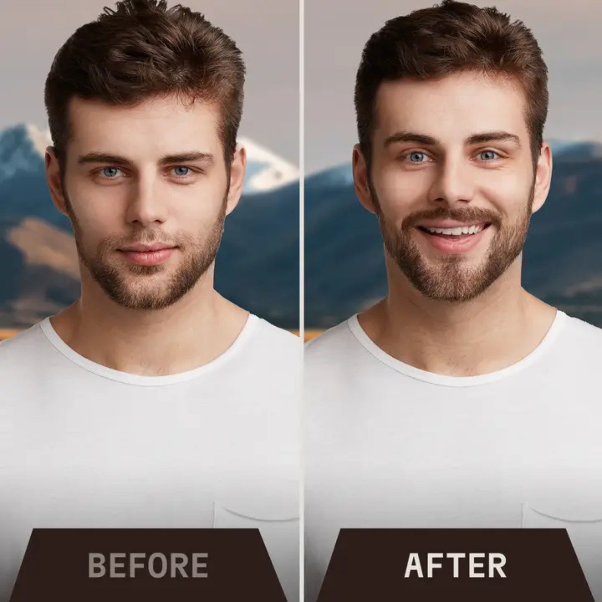 Striking Viking Sandalwood Beard Growth Kit with Biotin Oil & 0.25mm Derma Roller