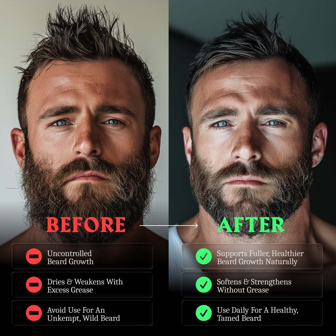 Beard Oil - Bergamot Thunder
